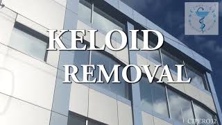 Keloid Removal Left Ear Lobe Removal [upl. by Kavanaugh]