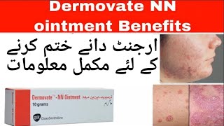 Dermovate NN ointmentHow to use dermovate for skin fungal infections remove acne pimple scar [upl. by Vitus]