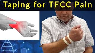 How to Tape your Wrist for Ulnocarpal Pain and TFCC Injuries [upl. by Rosmunda587]