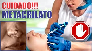 Peligroso METACRILATO 🚫🚫 ¡¡¡Cuidado 🆘 Retiro de METACRIL 🚫 Biopolímeros 🚷 Dr ALBERTO CALVO QUIROZ [upl. by Iggie943]