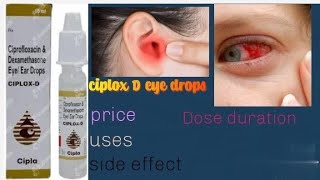 ciplox D eyes and ear drops ka istemal [upl. by Etienne343]