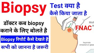 Biopsy test कैसे किया जाता है  Biopsy की रिपोर्ट कैसे देखते है  Excisional amp Incisional biopsy [upl. by Wallach19]