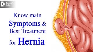 What is Hernia Symptoms Causes Types Treatment  Dr Harish N S  Doctors Circle [upl. by Etram]