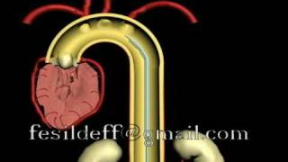 IABP Intraaortic Ballon Pump [upl. by Okiram]