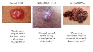 Dermatology on USMLECOMLEX [upl. by Daza]