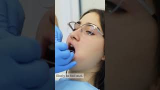 How to Prevent Your Root Canal Filling from Falling Out 7 Easy Tips [upl. by Leta211]