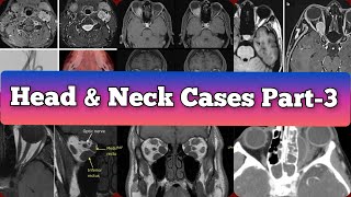 Radiology Viva Cases  386392  Head and Neck Exam Cases Part 3 medical radiology [upl. by Omrelliug]