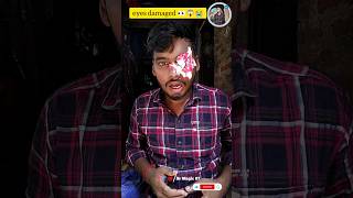 eyes damaged 👁️👁️😱magic tricks lifehacks viral trending shortfeed shorts [upl. by Nna]