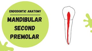 Endodontic Anatomy of the Mandibular Second Premolar  Root canal anatomy [upl. by Ohcirej]