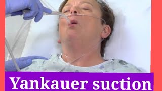 Yankauer Suction Tubes overview [upl. by Mozza]