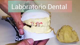 Encerado para procesar prótesis dentales flexibles [upl. by Neelrahs166]