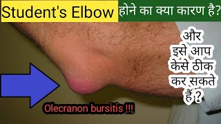 Olecranon Bursitis Elbow Bursitis  Students Elbow  Prevention Treatment Exercises amp Home Care [upl. by Lynnet3]