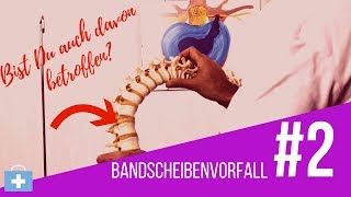 Bandscheibenvorfall😲Das passiert in Deinem Köper⚠️ [upl. by Ingelbert]