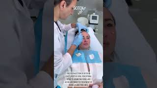 Botox Injection Preparation and Precision Placement for Wrinkle Treatment [upl. by Marillin510]