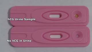 Human Chorionic Gonadotropin HCG  Pregnancy Test Tamil [upl. by Anikehs]