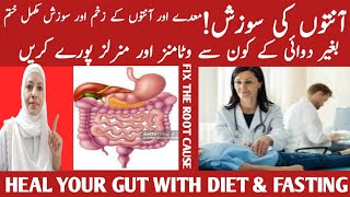 How To Improve Gut Health And Digestion Best And Worst Foods For Gut Health Listen Your Body [upl. by Nomyaw]