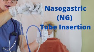 Nasogastric NG Tube Insertion [upl. by Sheffy]