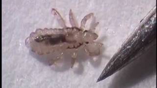 Removing Head Lice Safely [upl. by Dlaregztif]