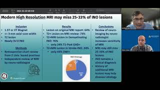 Internuclear Ophthalmoplegia INO on MRI [upl. by Niveek]