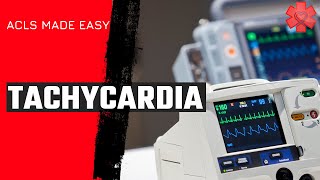 ACLS Tachycardia Algorithm [upl. by Tanner796]