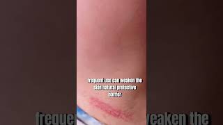 Watch This Before Using Hair Removal Creams ⚠️Dermatology Tips [upl. by Akineg341]