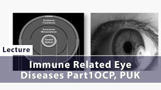 Immune Related Eye Diseases Part 2 Scleritis Episcleritis [upl. by Adiaj]