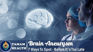 7 Ways To Spot A Brain Aneurysm Before Its Too Late [upl. by Enelyw]