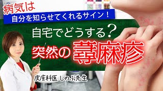 【自宅で突然の蕁麻疹どうする？】とるべき行動 市販薬は効く？病気は自分を知らせてくれるサイン！ [upl. by Aihsirt666]