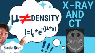 Xray Attenuation Coefficients  Xray Attenuation Calculator  A level Medical Physics [upl. by Oscar802]