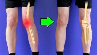 Knee Pain This Is DESTROYING Your Knees [upl. by Llieno]