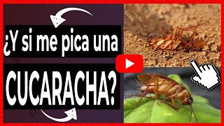 CUCARACHA 🔴 ¿Qué pasa si me pica una cucaracha [upl. by Kuska]