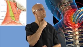 90Second Relief Technique for a Stiff Neck Wry Neck Torticollis  khabar station [upl. by Euqinobe]