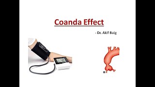 Coanda effect  Dr Akif Baig [upl. by Drawets]