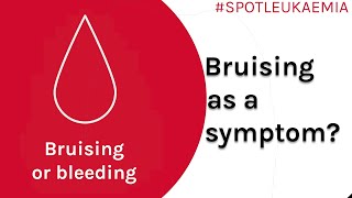 Bruising Symptom Spotlight  Spot Leukaemia [upl. by Zizaludba909]