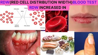 RDWRED CELL DISTRIBUTION WIDTH BLOOD TEST NORMAL RANGE CAUSES OF HIGH RDW HOW TO REDUCE IT [upl. by Arikihs932]