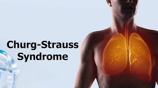 Churg Strauss Syndrome  Eosinophilic Granulomatosis With Polyangiitis Causes and treatment [upl. by Penelopa163]