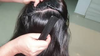 Hair parting scalp check for flakes hair braiding  ASMR [upl. by Nauqyaj806]