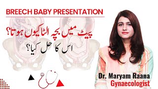 Breech Baby Position Pregnancy  Bacha Ulta Ho To Dr Maryam Raana Gynaecologist [upl. by Inittirb732]