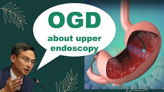 【OGD upper endoscopy】 information [upl. by Lledyl]