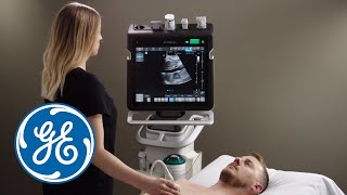 Venue Ultrasound  Auto IVC Demo  GE Healthcare [upl. by Llenna]