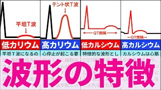 【8分で解説、10分で国試問題】電解質の異常と心電図波形の特徴 [upl. by Malchy]