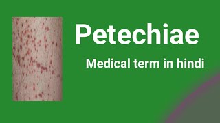 PetechiaeMedical term in hindi [upl. by Wallinga908]