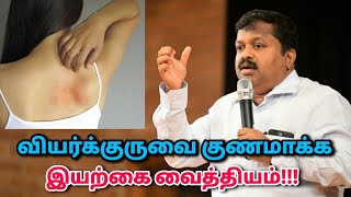 வியர்க்குரு குணமாக உடல் சூடு குறைய பாட்டி வைத்தியம்  DrSivaraman speech on heat rash remedy [upl. by Tomkiel]