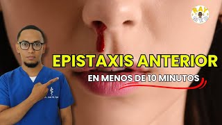 Epistaxis Anterior explicado fácilmente  ORL [upl. by Zurheide]