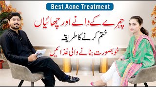 Pimples and Acne Treatment At Home  Skin Care Routine  Dr Huria Arooj  Dr AR Madha [upl. by Sirromaj229]