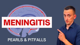 BACTERIAL MENINGITIS IN ADULTS SYMPTOMS CAUSES DIAGNOSIS AND TREATMENT [upl. by Nelly]