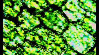 Plasmolysis in elodea cells lauren [upl. by Eelsel]