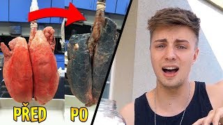 VAŠE PLÍCE PO 100 ClGARETÁCH 😲  EXPERIMENT [upl. by Gina]