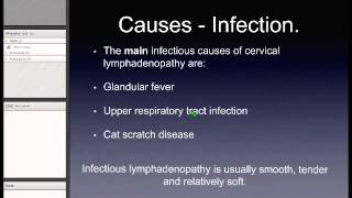 Cervical Lymphadenopathy [upl. by Casabonne]