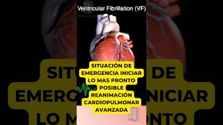 fibrilación ventricular medicina corazon arritmias emergency medico latidodelcorazón heart [upl. by Herrington]